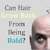 Can Hair Grow Back From Being Bald?