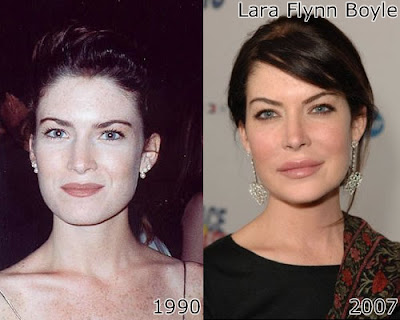 lara flynn boyle lips