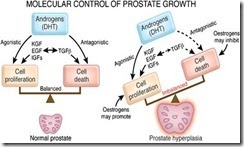 Catatan Kuliah BENIGN PROSTATIC HYPERPLASIA BPH 