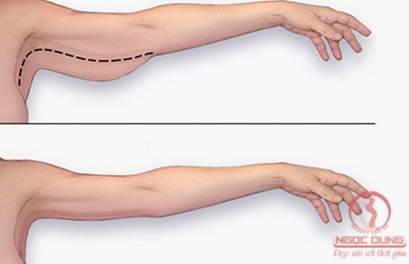 10 động tác đơn giản giúp giảm mỡ bắp tay nhanh chóng ngay tại nhà