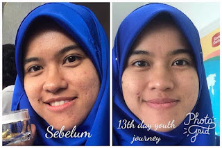 Image result for testimoni youth skincare