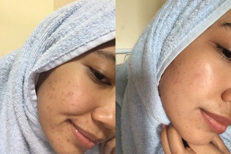 Nurul Arifah Abd Rahim Positive Feedback About Vitamin C Shaklee