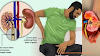Kidney stone symptoms and prevention