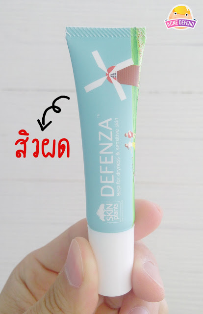 รักษาสิวผดด้วย Defenza cream