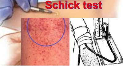 What Is a Schick Test