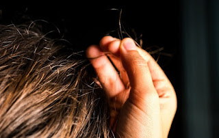 Penyebab dan Cara Menghilangkan Kebiasaan Mencabut Rambut_