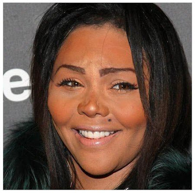 Lil Kim Rhinoplasty Gone Wrong