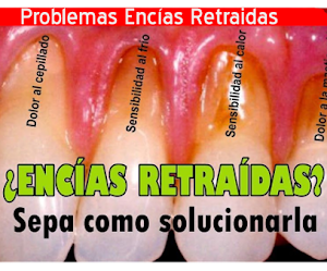 Problemas de Encías Retraidas