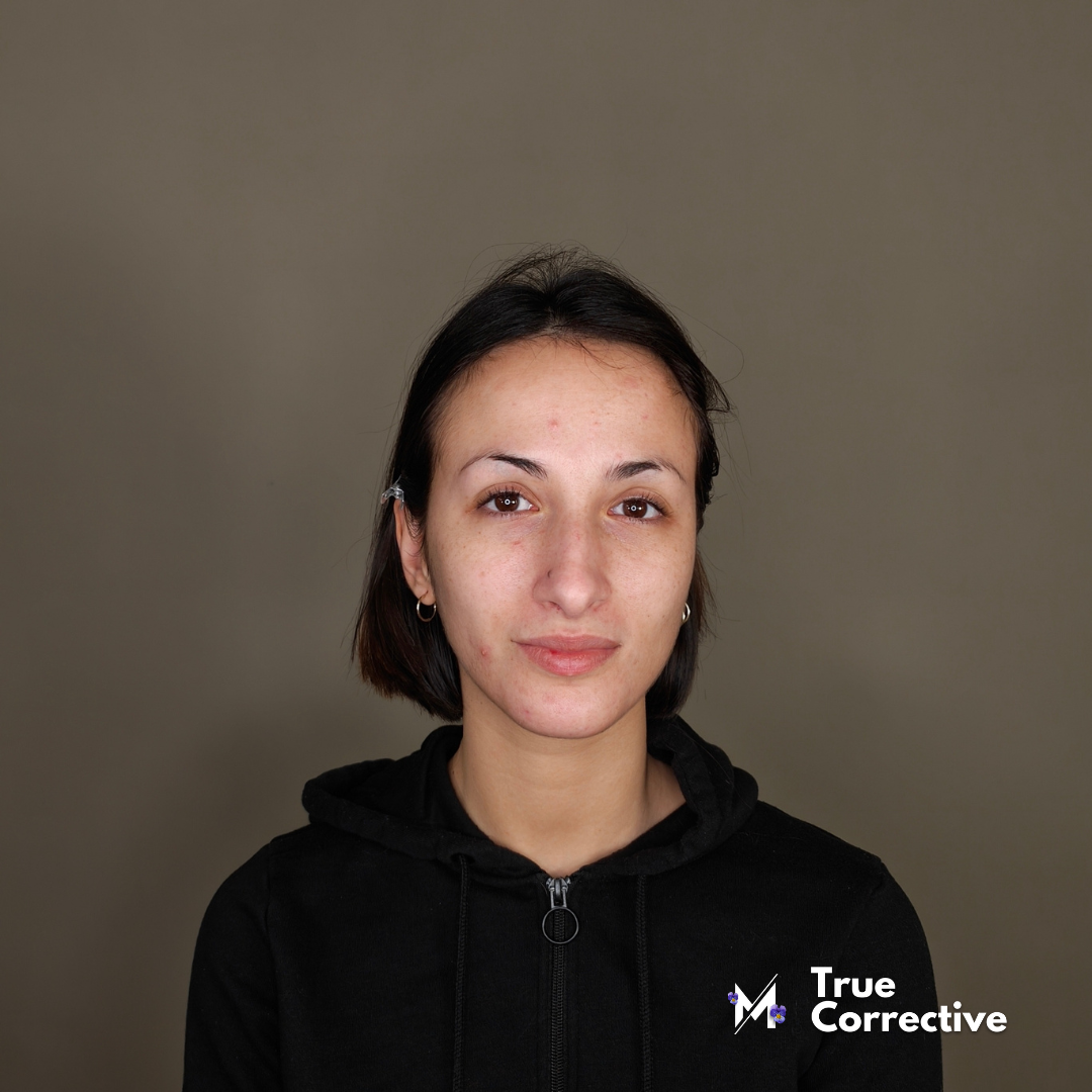 True Corrective Corso Make Up Online Pelle Sensibile e Reattiva