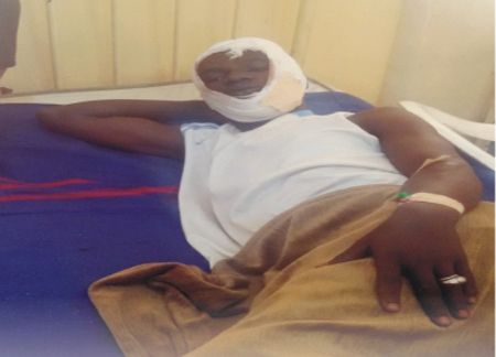 survivor of Kano GSM market blast 