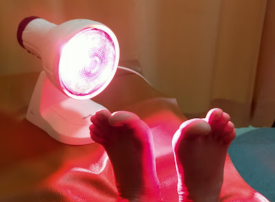 Infrared plantar fasciitis