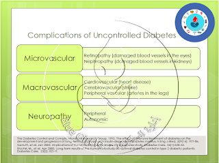 إعتلال الاعصاب Neuropathy 