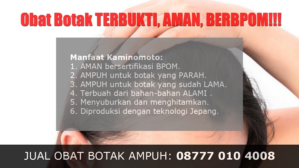 jual OBAT PENUMBUH RAMBUT BOTAK Purwodadi<br/>