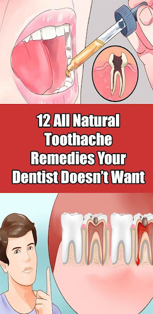12 Toothache Cures of Nature – Dentists Hide This Advice