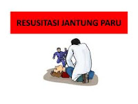 Resusitasi Jantung Paru