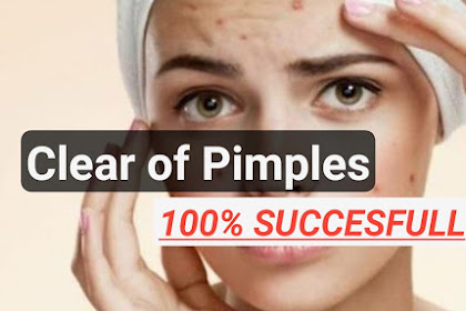  13 Ways How to get rid of pimples naturally 100% successful