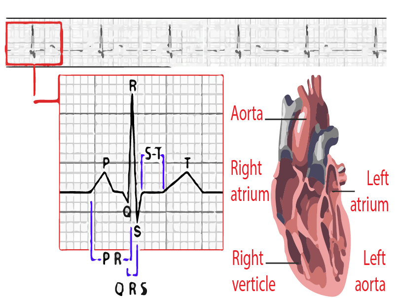 ECG - cardiology