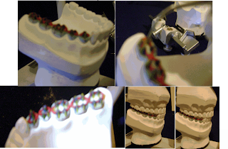 OdontoBlog Anatomia Escultura de Dentes em Cera
