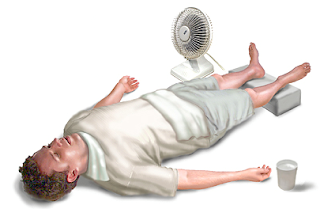 heat stroke is a medical emergency !