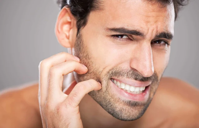 8 Common Skin Problems in Men and How to Treat Them Naturally