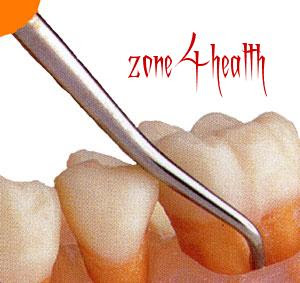 Beware of impact of cavities