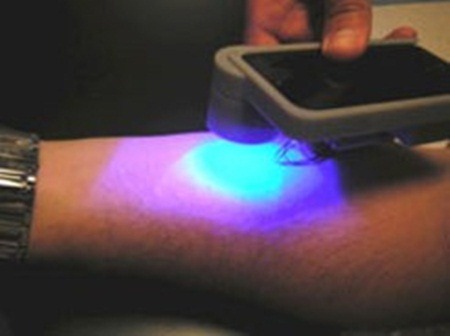 iphone biomedicina
