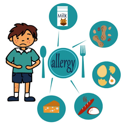 Food Allergies