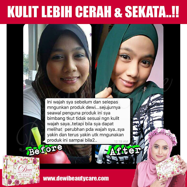 Dewi Beauty Care Skincare Murah