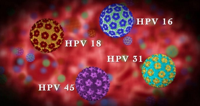 Penyakit Candyloma