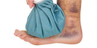 Sprains and Strains Treatment