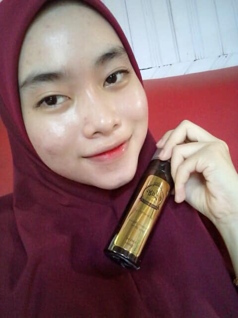 LEPAS GUNA AURA BEAUTY SPRAY JERAWAT HILANG