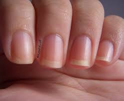  How to grow strong and healthy nails naturally