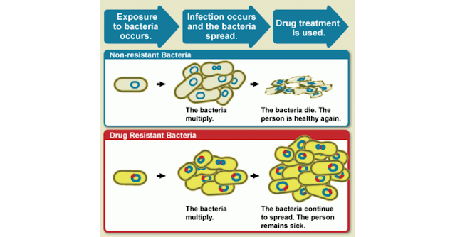 Bacterial Infections: परिचय, बैक्टीरिया संक्रमण के प्रकार, लक्षण व कारण