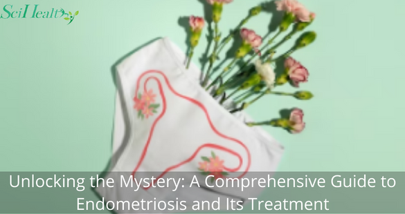 Unlocking the Mystery: A Comprehensive Guide to Endometriosis and Its Treatment