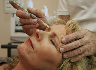 Botox Treatments