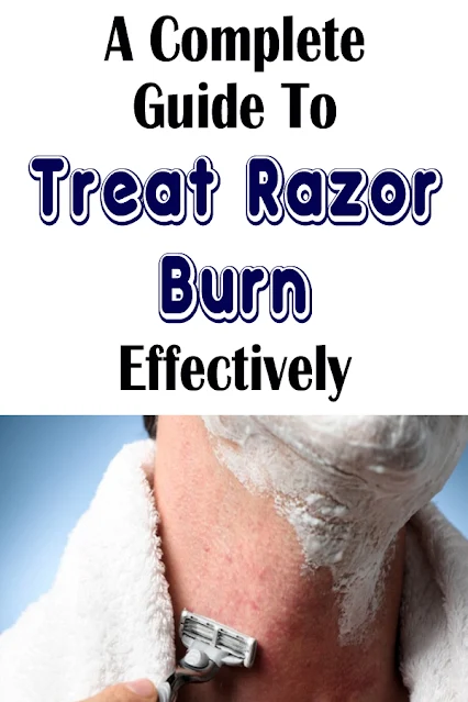 A Complete Guide To Treat Razor Burn Effectively