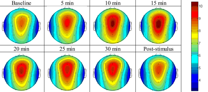 図：シータバイノウラルビートの脳波分布