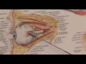 Generally in the wake of doing eye surgery los angeles, we will additionally be given the alternative to counsel. It is exceptionally valuable to the visual conclusion we need. Obviously this is carried out at a certain time with the goal that it can furnish better comes about. Actually, a few specialists prompted us to give an extremely exceptional timetable for this counsel. Additionally, it is to offer impact to the state of our eyes after surgery. Some individuals who have done this eye surgery conference will normally just when she felt torment in certain parts. This is not a huge issue, yet we might as well counsel when our eyes are likewise under typical conditions.