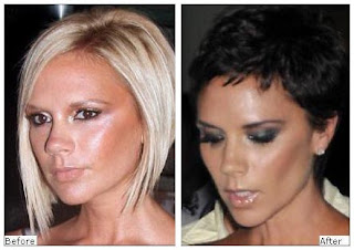 Victoria Beckham Plastic Surgery