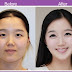 Step by step directions to search out A cosmetic surgeon in Asian country For the best Results 