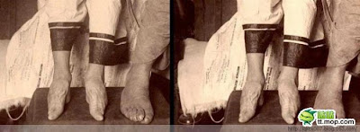 Chinese Women with Deformed Feet Seen On  www.coolpicturegallery.us