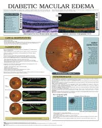 Edema Macular Diabético