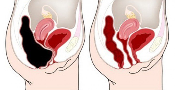 Remove Toxins From The Colon By Pressing This Point In Your Stomach