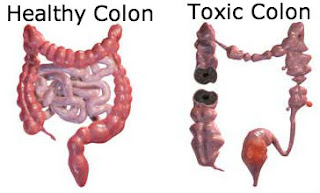 Super Detox Colon Cleanse - Eliminating the Impurities Quickly