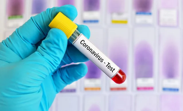 المهدية: تسجيل 41 إصابة جديدة بفيروس كورونا