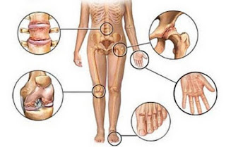 anti-inflammatoires naturels