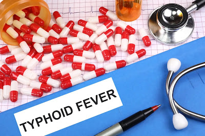 typhoid fever possible causes symptoms and cure tips