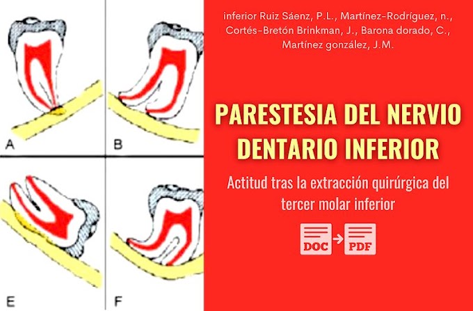 PDF: Actitud ante una posible parestesia del nervio dentario inferior tras la extracción quirúrgica del tercer molar inferior