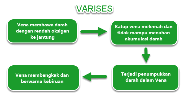 Varises