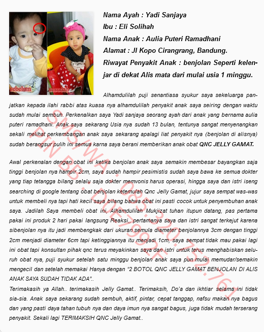 agen obat herbal jelly gamat QNC di pontianak yang resmi